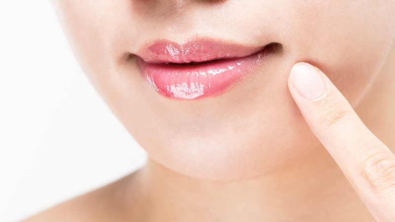 唇のシミの治療法とは？
